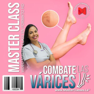 combate-las-varices